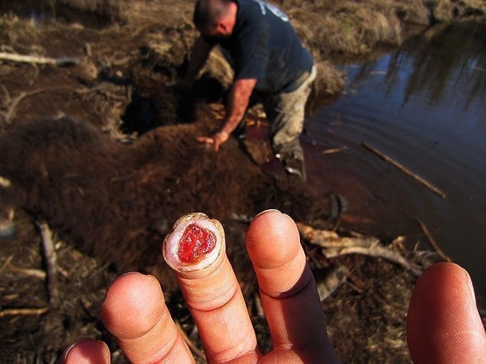 Cory Glauner Finger cut off on brown bear hunt